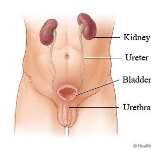 Urinary Tract Infection Webmd - Urinary Tract Infection Prevention - A Simple And Effective Way To Prevent Urinary Tract Infections
