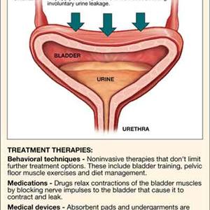 Information On Urinary Tract Infections - Natural Bladder Infection Remedies - How To Cure UTI With 3 Steps
