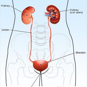 Causes Of Bladder Inflammation Experts - Surprise Results For Urinary Tract Infections, Vaginitis And Sexually Transmitted Diseases In African Trial